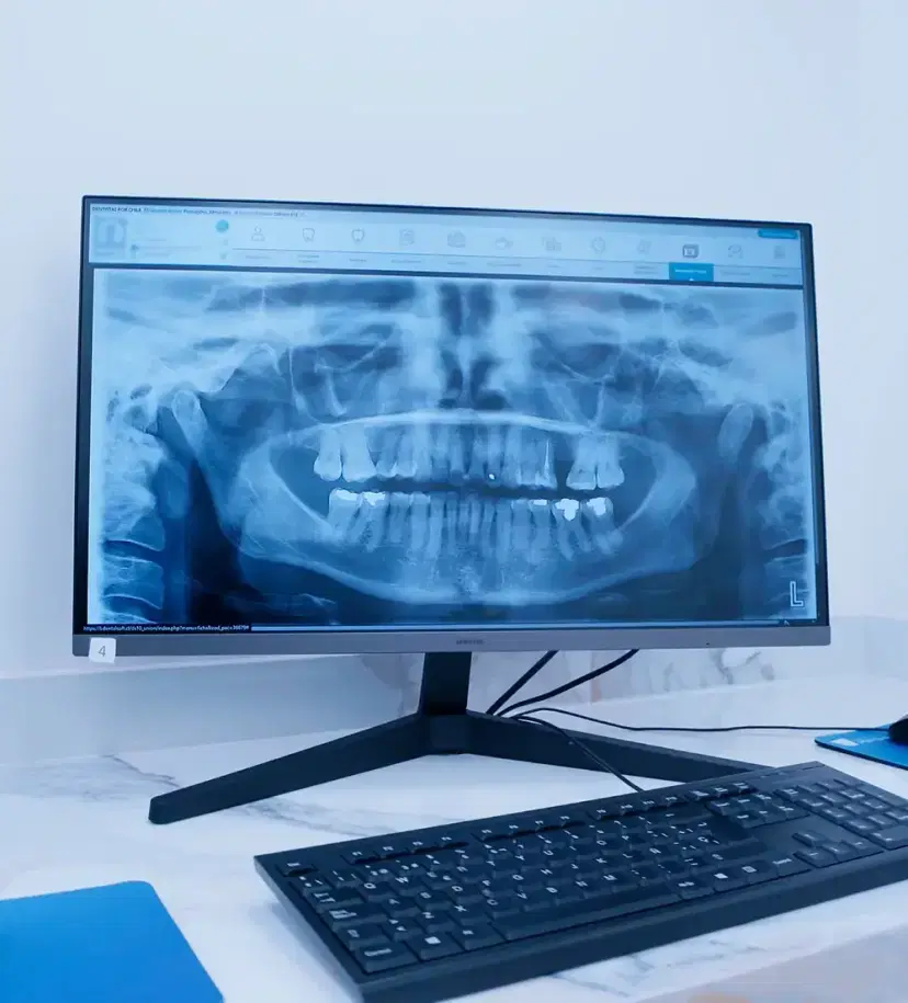 Equipos de radiología digital de la clínica
