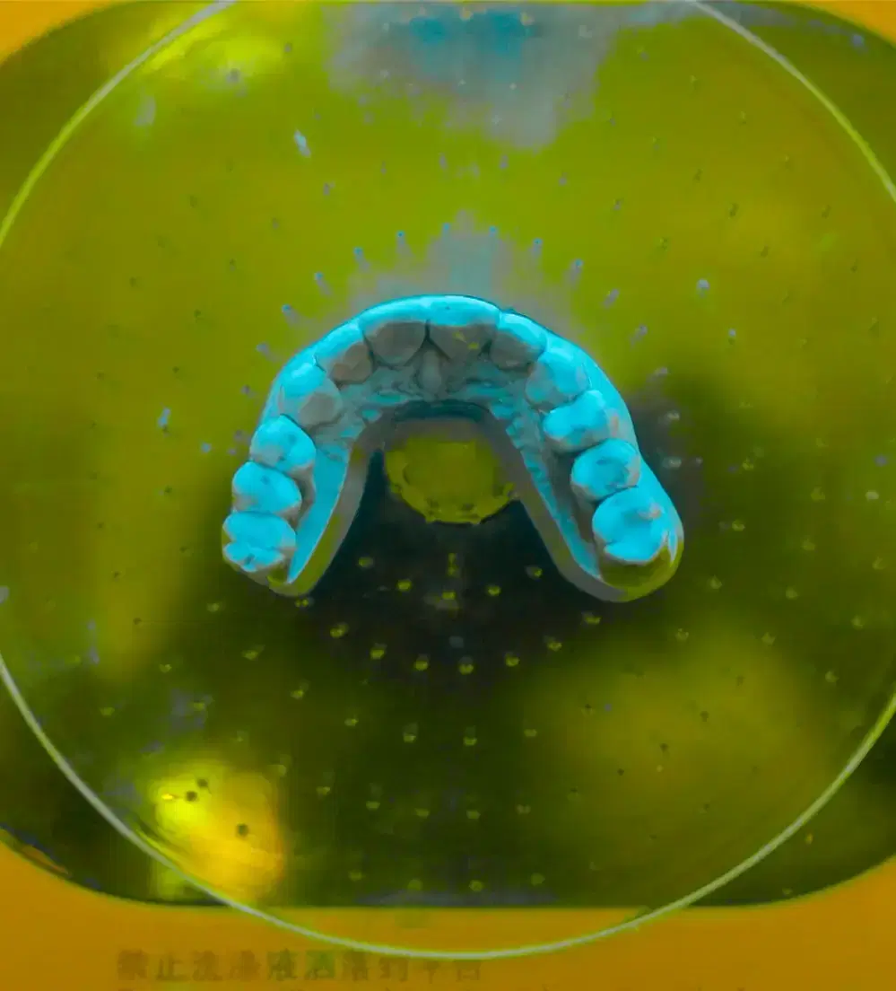 Férula dental en proceso de terminación en el laboratorio de Dentistas por Chile