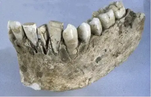 Aprende a Evitar los Malos Hábitos que Dañan tus Dientes