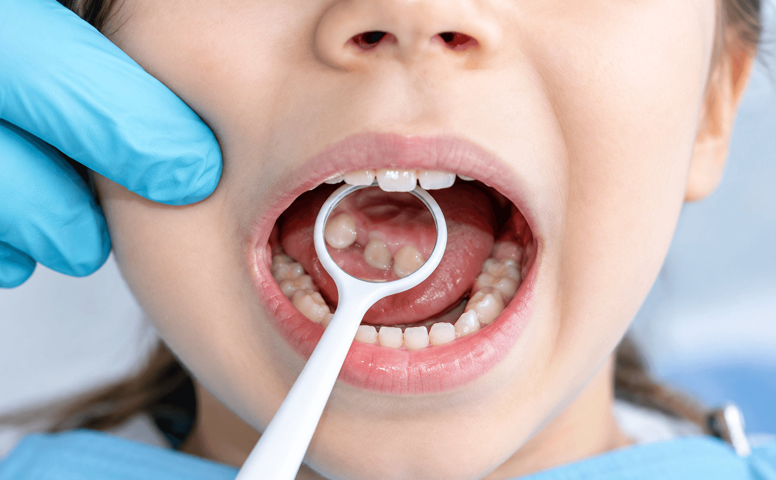 Malos hábitos bucales: cómo evitarlos y proteger tu sonrisa