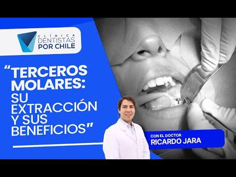 🦷 ¡Descubre el secreto detrás de la extracción de muelas!