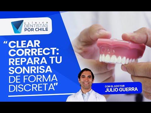 🦷 ¡Corrige tus Dientes! Descubre la Solución Perfecta.