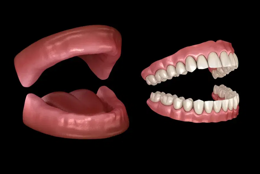 Los rebordes sin dientes a un lado y las dos prótesis completas al otro
