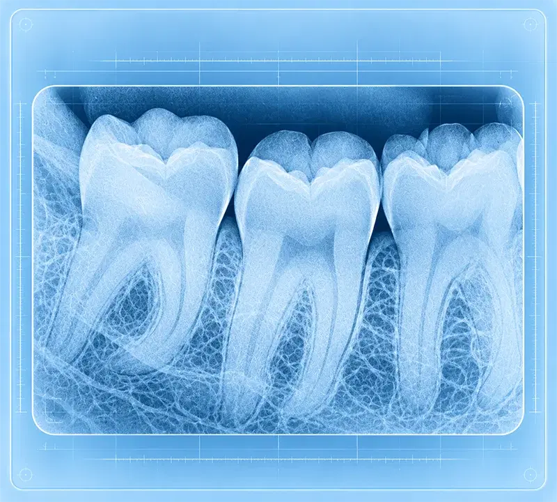 Radiografía periapical: dientes completos, desde la corona hasta la raíz