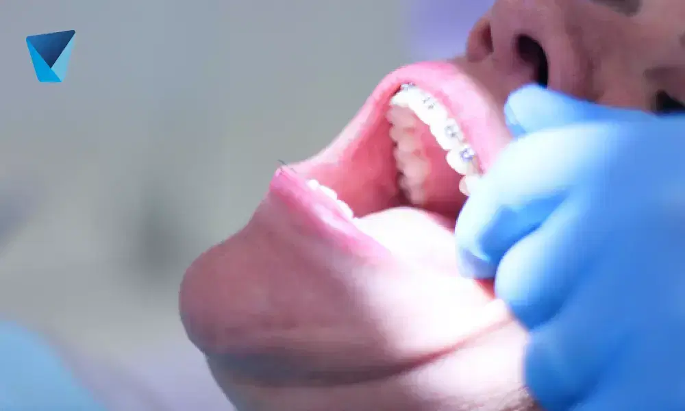 Comparativa detallada entre cepillo eléctrico y manual para una higiene bucal óptima en Chile. Descubre cuál es la mejor opción para tu salud dental según expertos odontólogos. Cepillo eléctrico vs. manual: Guía para elegir en Chile