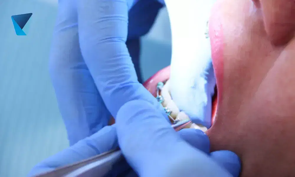 Aprende técnicas efectivas de limpieza e higiene para mantener tu cepillo dental en óptimas condiciones. Descubre cómo extender su vida útil y asegurar una salud bucal óptima, con consejos prácticos para el hogar en Chile. Limpieza y Cuidado del Cepillo Dental: Guía Esencial en Chile