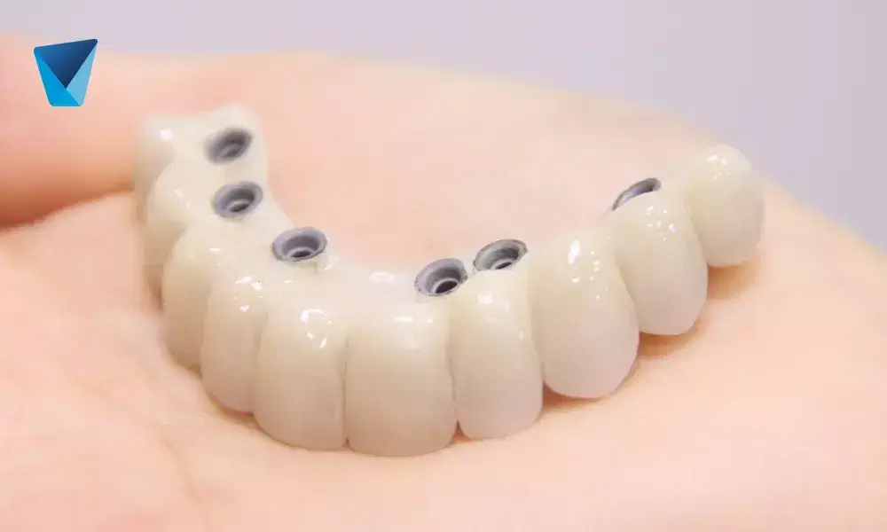 Descubre la longevidad de los implantes dentales en Chile y aprende estrategias efectivas para mantenerlos en óptimas condiciones por más tiempo, asegurando una sonrisa saludable y duradera. Duración de Implantes Dentales y Consejos para Prolongar su Vida Útil