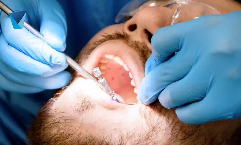 Descubre las graves consecuencias de no cepillarse los dientes regularmente. Aprende sobre caries, enfermedad periodontal, mal aliento y otros problemas de salud bucal. Mantén tu sonrisa sana con buena higiene. Consecuencias de no cepillarse los dientes: Impacto en tu salud bucal
