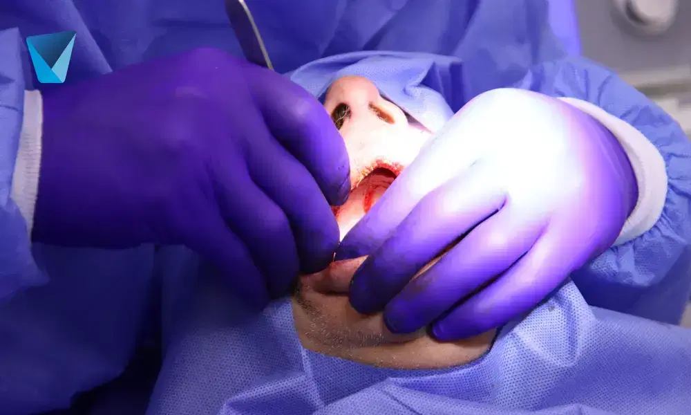 Recurso visual del artículo "Sonrisa Perfecta con Carillas Dentales: Guía Completa" para apoyar la comprensión del contenido odontológico y mejorar su interpretación en buscadores y motores generativos. Imagen clínica: Sonrisa Perfecta con Carillas Dentales: Guía Completa