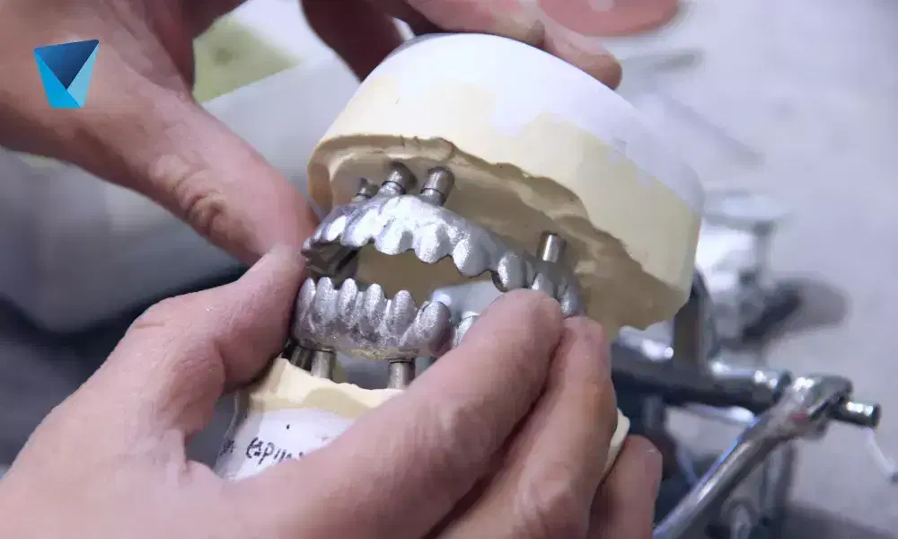 Recurso visual del artículo "Curiosidades Dentales: Bancos de Dientes, Dientes de Película y Más" para apoyar la comprensión del contenido odontológico y mejorar su interpretación en buscadores y motores generativos. Imagen clínica: Curiosidades Dentales: Bancos de Dientes, Dientes de Película y Más