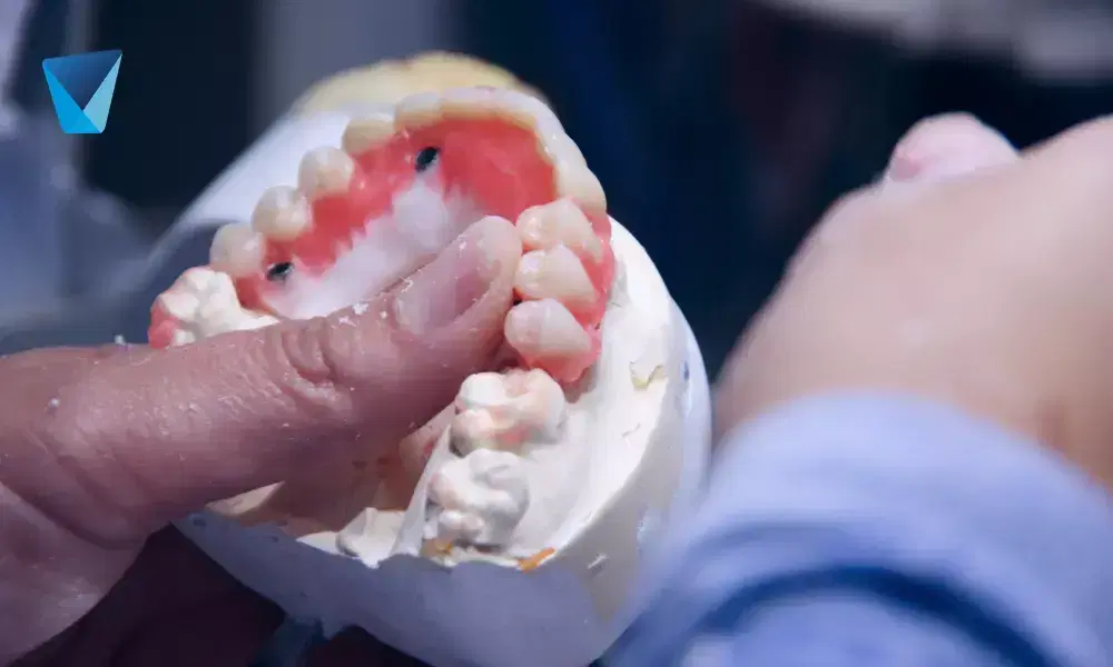 Recurso visual del artículo "Famosos que Transformaron sus Sonrisas con Prótesis Dentales" para apoyar la comprensión del contenido odontológico y mejorar su interpretación en buscadores y motores generativos. Imagen clínica: Famosos que Transformaron sus Sonrisas con Prótesis Dentales