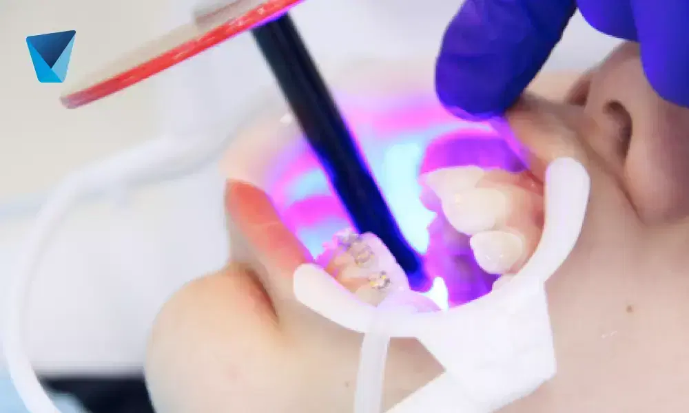 Descubre el proceso detallado para un diseño de sonrisa armónico y estético. Conoce los pasos, beneficios y resultados esperados de este tratamiento odontológico integral en Chile, ideal para mejorar la apariencia y confianza. Diseño de Sonrisa Paso a Paso: Guía Completa en Chile