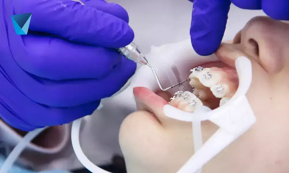Descubre el momento ideal para iniciar un tratamiento de ortodoncia en niños y adultos. Conoce los beneficios de la detección temprana y la evaluación profesional en tu clínica dental de confianza en Chile. Clínica Dental: Cuándo empezar tratamiento de ortodoncia en Chile