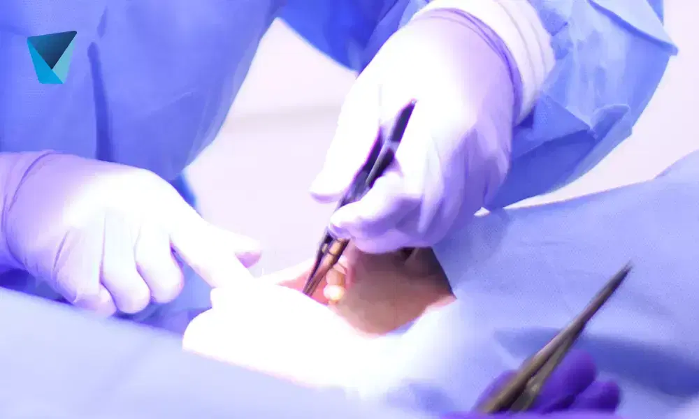 Recurso visual del artículo "Todo lo que debes saber sobre el tratamiento de la piorrea o periodontitis" para apoyar la comprensión del contenido odontológico y mejorar su interpretación en buscadores y motores generativos. Imagen clínica: Todo lo que debes saber sobre el tratamiento de la piorrea o periodontitis