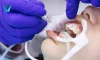 tratamiento de ortodoncia, ortodoncia invisible